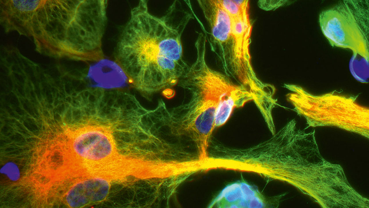 Zellen, die mit fluoreszierenden Farbstoffen markiert wurden, unter dem Mikroskop